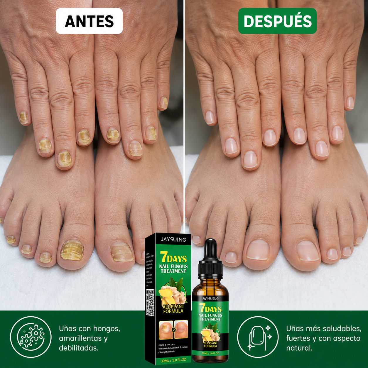 Tratamiento para Hongos en Uñas – Pies y Manos (30 ml)