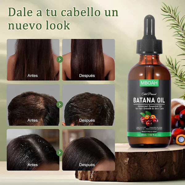 ACEITE DE BATANA - FORMULA MEJORADA 100% NATURAL