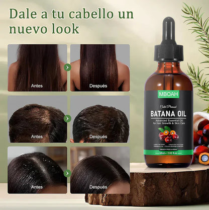 ACEITE DE BATANA - FORMULA MEJORADA 100% NATURAL